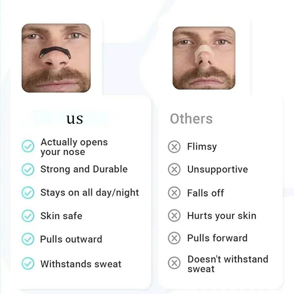 NoEnName_Null Nasal Breahing Dilators.