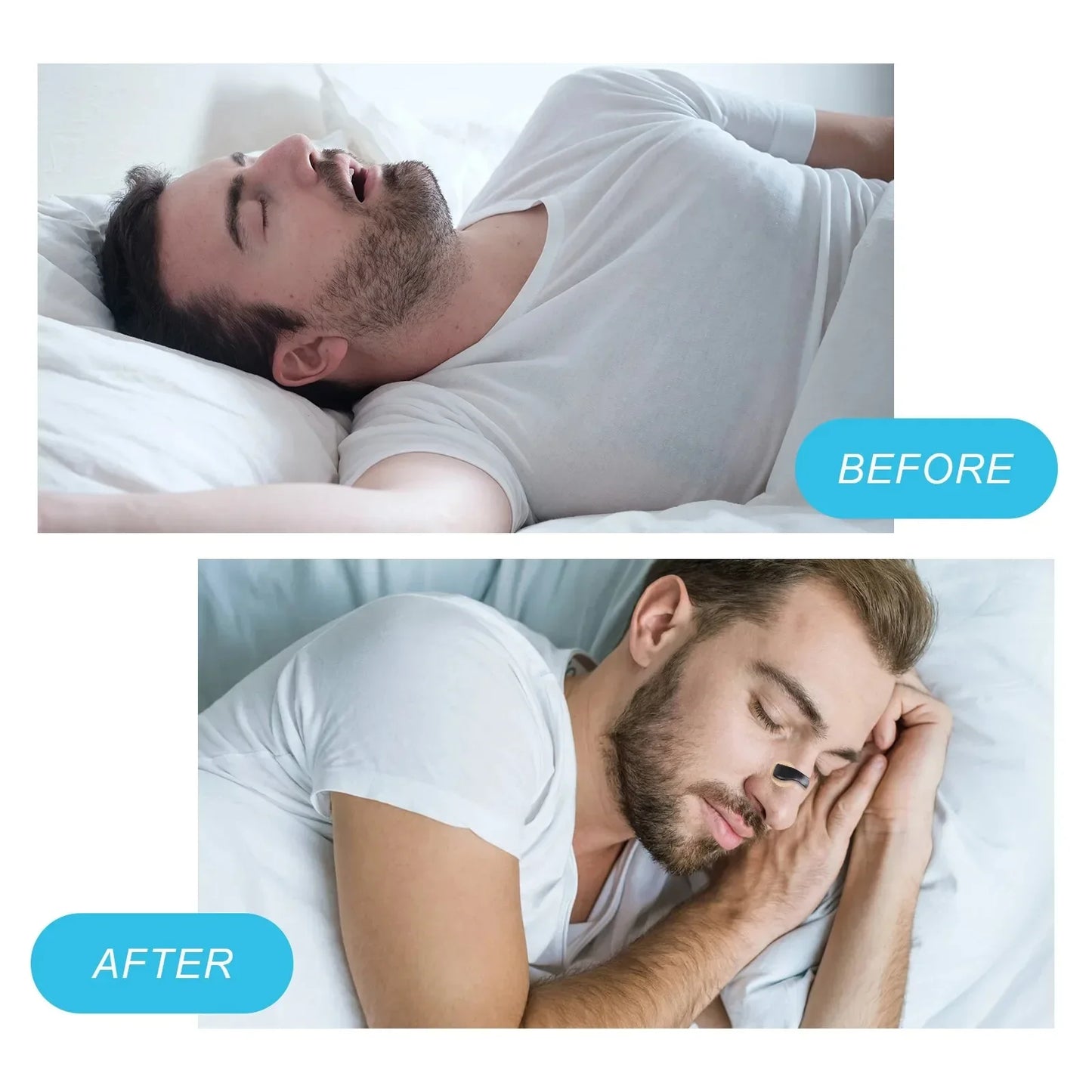 NoEnName_Null Nasal Breahing Dilators.