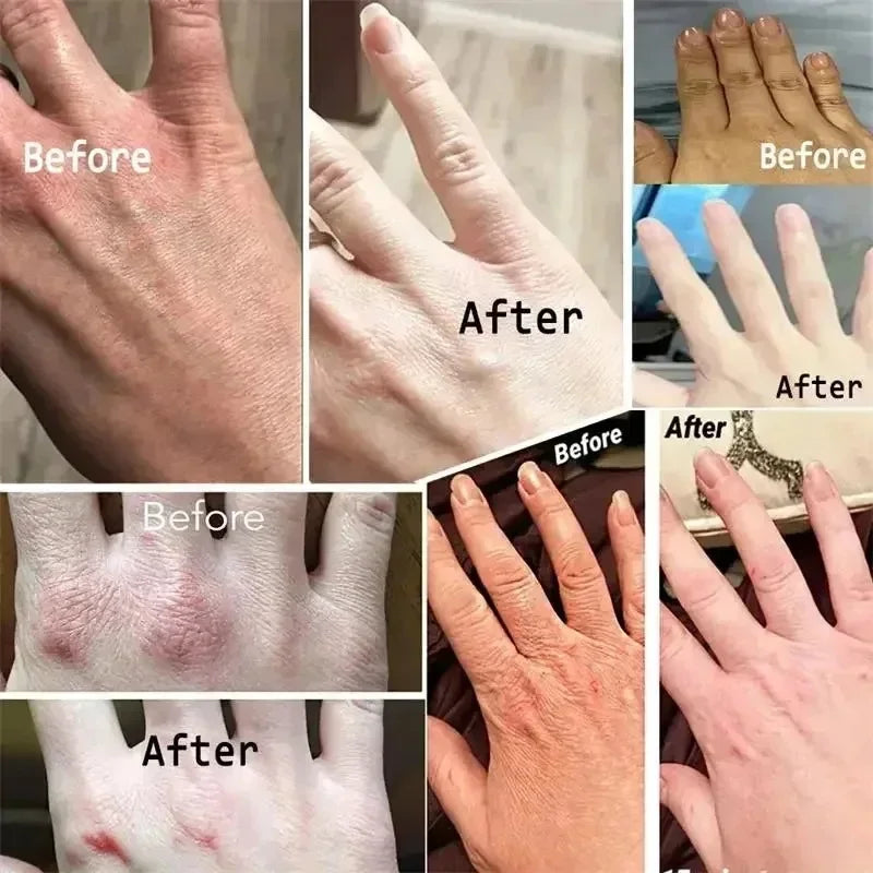 eelhoe Kojic Acid Cream.