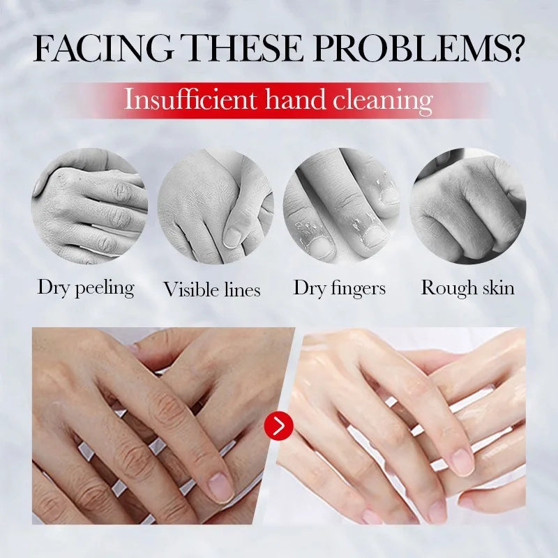 eelhoe Kojic Acid Cream.